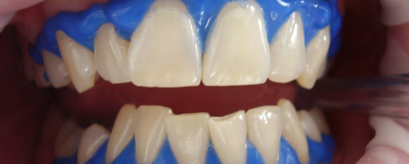 Gums